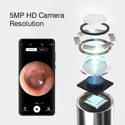 3.9mm HD Otoscopio digital de oído WiFi con función direccional de IA y conectividad WiFi