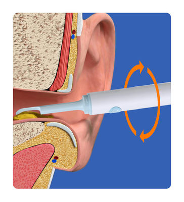 Rodas inteligentes de limpieza de oído visual con cámara médica Endoscopio para otros productos químicos domésticos